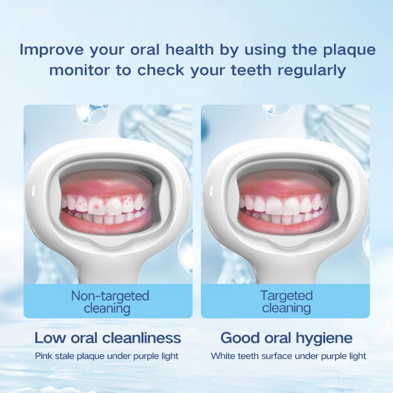 PD-01 Dental plaque detector